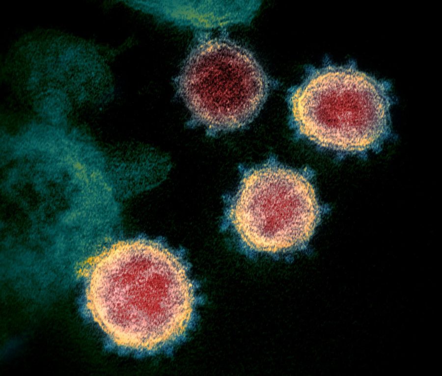 Microscopic cells of COVID-19 surround a group of healthy cells. 